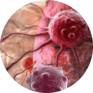 Tumor types